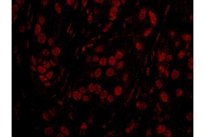 Immunofluorescence (IF) image for anti-Topoisomerase I Binding, arginine/serine-Rich, E3 Ubiquitin Protein Ligase (TOPORS) (AA 995-1045) antibody (ABIN7449029)