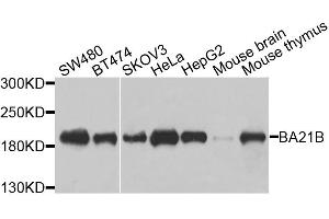 Western blot analysis of extracts of various cell lines, using BAZ1B antibody. (BAZ1B 抗体)