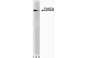 Western blot analysis of RAD50 on a Jurkat cell lysate (Human T-cell leukemia, ATCC TIB-152). (RAD50 抗体  (AA 672-786))