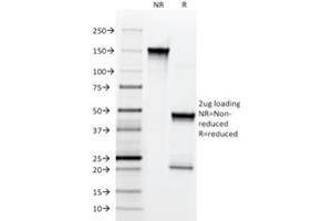 SDS-PAGE Analysis Purified NGFR Mouse Monoclonal Antibody (NGFR5). (NGFR 抗体)