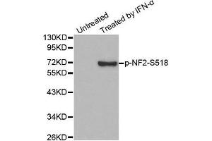 Western blot analysis of extracts from HUVEC cells, using Phospho-NF2-S518 antibody. (Merlin 抗体  (pSer518))