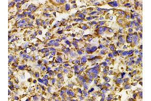 Immunohistochemistry (IHC) image for anti-Phosphoinositide 3 Kinase, p85 alpha (PI3K p85a) (pTyr607) antibody (ABIN6256775)