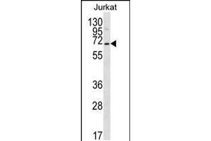 Western blot analysis in Jurkat cell line lysates (35ug/lane). (PSAPL1 抗体  (N-Term))