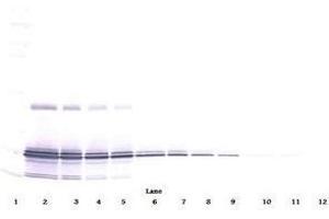Image no. 1 for anti-Interleukin 11 (IL11) antibody (ABIN465144) (IL-11 抗体)