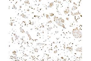 Immunocytochemistry (ICC) image for anti-gamma Histone Variant H2AX (GAMMA-H2AX) (Ser140) antibody (ABIN7454026) (Recombinant gamma H2AX 抗体  (Ser140))