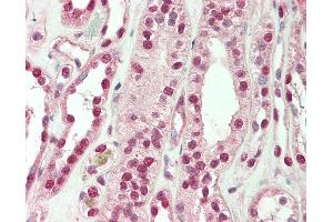 Immunohistochemistry (IHC) image for anti-SWI/SNF Related, Matrix Associated, Actin Dependent Regulator of Chromatin, Subfamily A, Member 4 (SMARCA4) (AA 75-125) antibody (ABIN2628535)