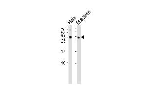 Western blot analysis of lysates from Hela cell line mouse spleen tissue lysate(from left to right), using TCF21 Antibody (C-term) (ABIN655524 and ABIN2845037). (TCF21 抗体  (C-Term))