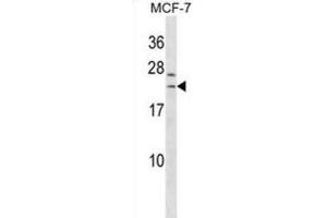 Western Blotting (WB) image for anti-SAP30-Like (SAP30L) antibody (ABIN3000391) (SAP30L 抗体)