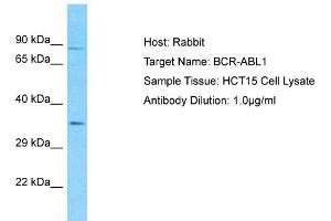 Host: Rabbit Target Name: BCR-ABL1 Sample Type: HCT15 Whole Cell lysates Antibody Dilution: 1. (Oncogene Protein p190/bcr-Abl (N-Term) 抗体)