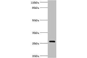 Western blot All lanes: OFCC1 antibody at 2 μg/mL + Mouse gonadal tissue Secondary Goat polyclonal to rabbit IgG at 1/10000 dilution Predicted band size: 27, 32, 21, 14, 16 kDa Observed band size: 27 kDa