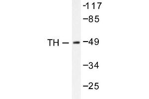 Image no. 1 for anti-Tyrosine Hydroxylase (TH) antibody (ABIN271856) (Tyrosine Hydroxylase 抗体)
