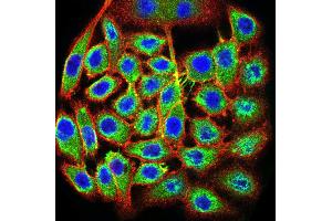 Immunocytochemistry (ICC) image for anti-Transcription Termination Factor, RNA Polymerase I (TTF1) (AA 1-150) antibody (ABIN5871603) (TTF1 抗体  (AA 1-150))