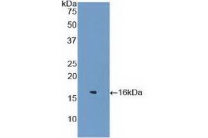 Detection of Recombinant LZM, Mouse using Polyclonal Antibody to Lysozyme (LZM) (LYZ 抗体  (AA 22-143))
