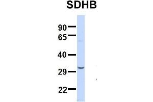 Host:  Rabbit  Target Name:  SERPINA3  Sample Type:  Human Adult Placenta  Antibody Dilution:  1. (SDHB 抗体  (Middle Region))