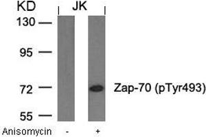 Western blot analysis of extracts from JK cells untreated or treated with anisomycin using Zap-70(Phospho-Tyr493) Antibody. (ZAP7 (pTyr493) 抗体)