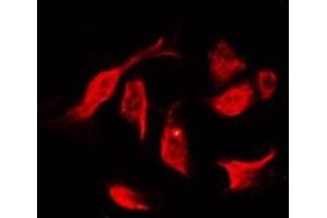 ABIN6267241 staining K562 by IF/ICC. (JAK2 抗体  (pTyr931))