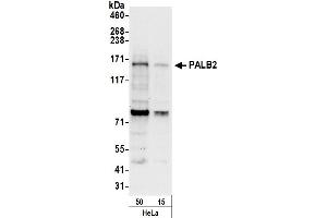 anti-Partner and Localizer of BRCA2 (PALB2) (AA 675-725) antibody