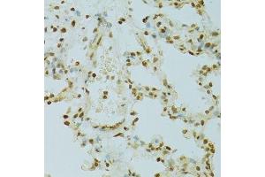 Immunohistochemistry of paraffin-embedded rat lung using RCC1 antibody. (RCC1 抗体  (AA 1-240))