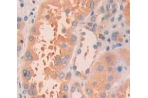 Used in DAB staining on fromalin fixed paraffin- embedded Kidney tissue (HRAS 抗体  (AA 82-176))