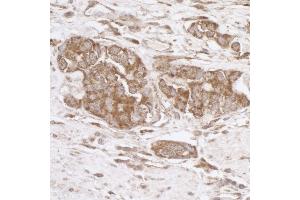 Immunohistochemistry (IHC) image for anti-TNF Receptor-Associated Protein 1 (TRAP1) (AA 600-650) antibody (ABIN7455063) (TRAP1 抗体  (AA 600-650))