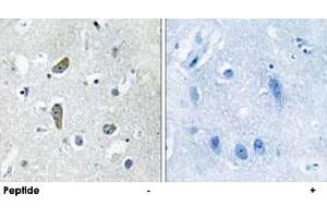 Immunohistochemistry analysis of paraffin-embedded human brain tissue using CDK5RAP2 polyclonal antibody . (CDK5RAP2 抗体)