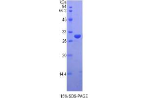 SDS-PAGE analysis of Human VRK1 Protein. (VRK1 蛋白)