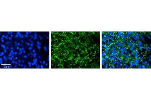 Rabbit Anti-AREL1 Antibody     Formalin Fixed Paraffin Embedded Tissue: Human Pineal Tissue  Observed Staining: Cytoplasmic in vesicles in cell bodies of pinealocytes  Primary Antibody Concentration: 1:100  Secondary Antibody: Donkey anti-Rabbit-Cy3  Secondary Antibody Concentration: 1:200  Magnification: 20X  Exposure Time: 0. (AREL1 抗体  (N-Term))