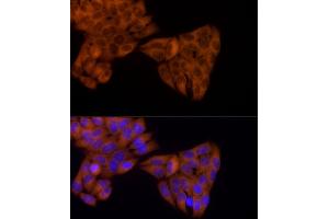 Immunofluorescence analysis of HeLa cells using KIF5B Rabbit mAb (ABIN7268135) at dilution of 1:25 (40x lens). (KIF5B 抗体)