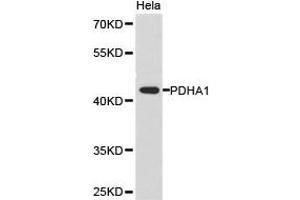 Western Blotting (WB) image for anti-Pyruvate Dehydrogenase (Lipoamide) alpha 1 (PDHA1) antibody (ABIN1874077) (PDHA1 抗体)
