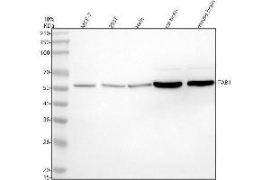 Western blot analysis of TAB1 using anti-TAB1 antibody (ABIN7606435).