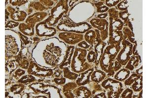 ABIN6279088 at 1/100 staining Human kidney tissue by IHC-P. (ADAMTS17 抗体)