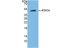 Detection of Recombinant CDH5, Rat using Polyclonal Antibody to Cadherin 5 (CDH5) (Cadherin 5 抗体  (AA 59-382))