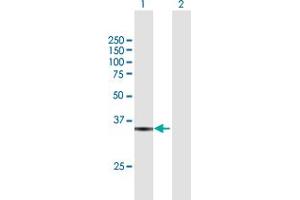 Western Blotting (WB) image for anti-Replication Factor C (Activator 1) 5, 36.5kDa (RFC5) (AA 1-340) antibody (ABIN948400)