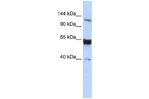 SYCP1 antibody used at 1 ug/ml to detect target protein. (SYCP1 抗体  (N-Term))