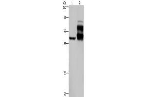 Western Blotting (WB) image for anti-Proprotein Convertase Subtilisin/kexin Type 9 (PCSK9) antibody (ABIN2435166) (PCSK9 抗体)