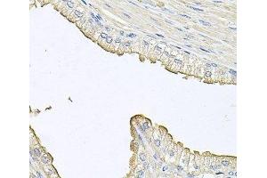 Immunohistochemistry of paraffin-embedded Human prostate using FABP12 Polyclonal Antibody at dilution of 1:100 (40x lens). (FABP12 抗体)