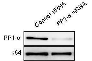 PPP1CA 抗体  (Center)