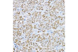 Immunohistochemistry of paraffin-embedded rat ovary using UBE2F Rabbit pAb  at dilution of 1:200 (40x lens). (UBE2F 抗体  (AA 1-185))