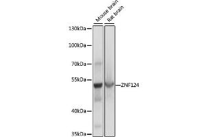 Western blot analysis of extracts of various cell lines, using ZNF124 antibody. (ZNF124 抗体)