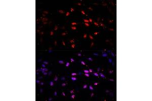 Immunofluorescence analysis of NIH/3T3 cells using KDM6B antibody (ABIN6131823, ABIN6142806, ABIN6142809 and ABIN6216507) at dilution of 1:100. (Kdm6b 抗体  (AA 265-450))