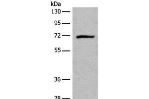 Western blot analysis of Jurkat cell lysate using ADGRE3 Polyclonal Antibody at dilution of 1:550 (EMR3 抗体)