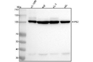 Western blot analysis of HIPK2 using anti-HIPK2 antibody (ABIN7605100).