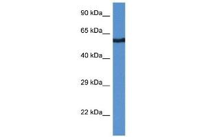 Western Blot showing CAMK2B antibody used at a concentration of 1 ug/ml against THP-1 Cell Lysate (CAMK2B 抗体  (Middle Region))