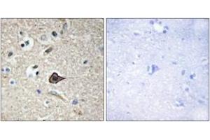 Immunohistochemistry analysis of paraffin-embedded human brain, using TNF12 Antibody. (TWEAK 抗体  (AA 41-90))