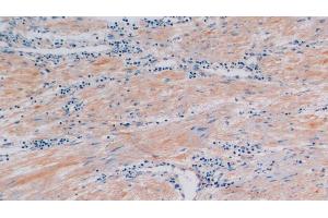 Detection of CTXI in Human Prostate Tissue using Polyclonal Antibody to Cross Linked C-Telopeptide Of Type I Collagen (CTXI) (CTX-I 抗体)