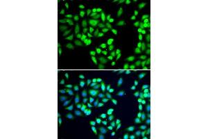 Immunofluorescence analysis of A-549 cells using SGTA antibody. (SGTA 抗体  (AA 1-120))