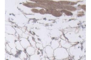 IHC-P analysis of Mouse Skin Tissue, with DAB staining. (Filaggrin 抗体  (AA 119-336))