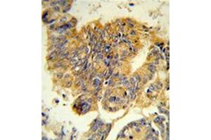 Immunohistochemistry (Paraffin-embedded Sections) (IHC (p)) image for anti-Colony Stimulating Factor 3 Receptor (Granulocyte) (CSF3R) (AA 259-288), (Middle Region) antibody (ABIN951155)