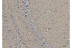 IHC analysis of EAAT1/SLC1A3 using anti-EAAT1/SLC1A3 antibody (ABIN7602879).