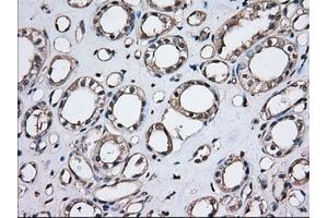 Immunohistochemical staining of paraffin-embedded Human Kidney tissue using anti-TBXAS1 mouse monoclonal antibody. (TBXAS1 抗体)